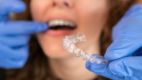 A woman getting clear braces for adults fitted to her teeth.