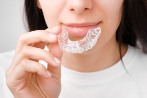 Close up of a woman using a mouthguard for sleeping