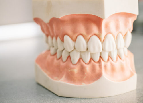 A mould showcasing the different types of teeth